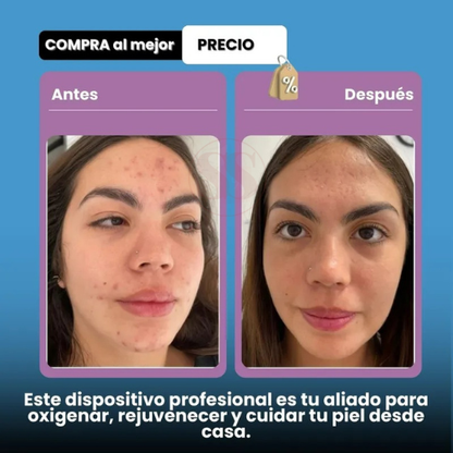 KIT FACIAL HIGH FRECUENCY GLOW PULSE™